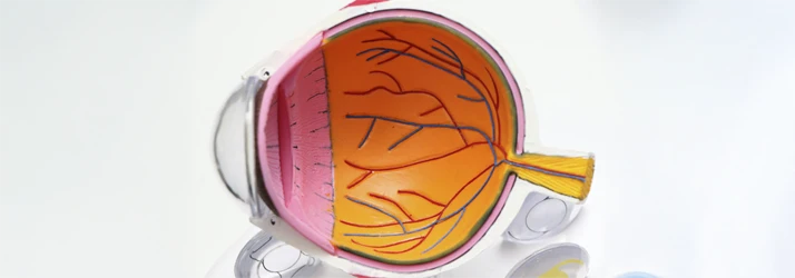 FC – Glaucoma in Austin TX